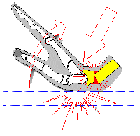 Sample picture wrist fracture